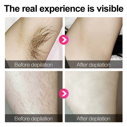 Epilator Usb Charging Razor Private Parts Manufacturer Hair Removal Instrument